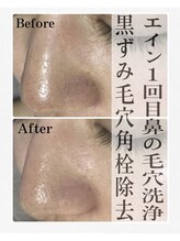 ジョルフ サロン オリジナル(JOLF salon original)/男性特有の皮脂汚れも除去！