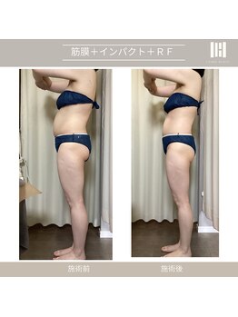 カリスボーテ 関本店/3ヶ月集中コース