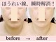 ガーデン(Garden)の写真