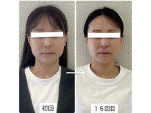 ラボーテヴェリテ(La Beaute Verite)/【お客様症例】