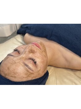 毛穴ケアをしたい