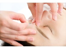 あさか美容整体院/効果実感の美容鍼