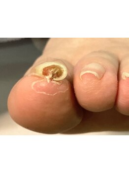 爪の悩みを解消できる（ケア含む）