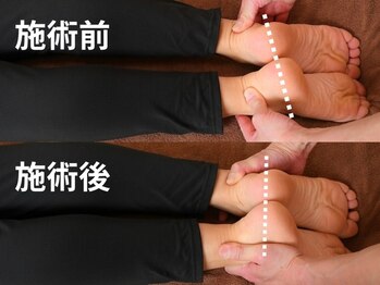 ポータラカ(Potalaka)/施術のビフォーアフター