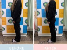 ベスト整骨院/beforeafter☆