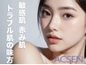 【SEN管理エステ】敏感肌/弱いお肌/ストレス/アクネケアに悩む現代人へ