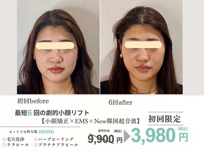 エスポワール(espoir)の写真