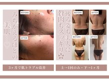 グロワール(gloire)の雰囲気（お肌のお悩み・背中の贅肉・後ろ姿・背中凝り・肩凝り）
