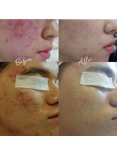 アンジェリック ビーナス(Angelic Venus)/