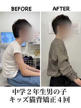 ネクスト鍼灸骨盤整骨院(Next鍼灸骨盤整骨院)/キッズ猫背