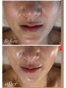 マリエンドリー/乾燥.くすみ