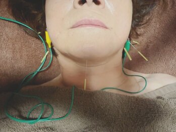 カナデ(kanade)/はり・きゅう -kanade- 奏