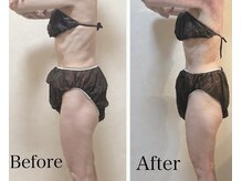 リブ 三軒茶屋(LiB)/骨格ケア、歪み改善