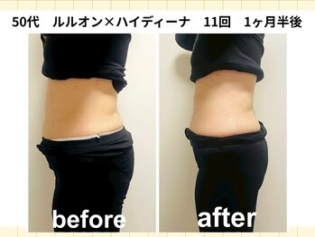 【本格痩身×よもぎ蒸し×リンパマッサージ】YOSAPARK Lulua 横浜・吉野町店の写真/【痩せない原因に集中アタック】進化系よもぎ蒸し×深部リンパマッサージで温活痩身◎理想の美ボディへ