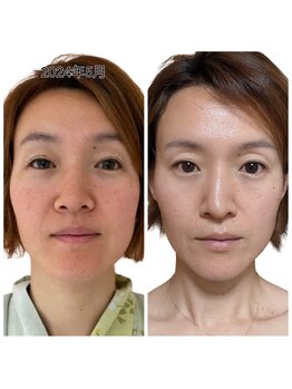 天使のしずくの写真/GWにもオススメ☆お顔、頭皮の施術、体の痛みに合わせたMENUをご用意♪年齢悩みに負けないわたしへ◎