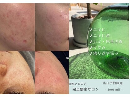 フットミー(foot mii)の写真