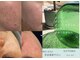 フットミー(foot mii)の写真