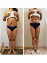 加圧ビューティーサロン スタイル エム(beauty salon style M)/50代／加圧×パワーツリー120分