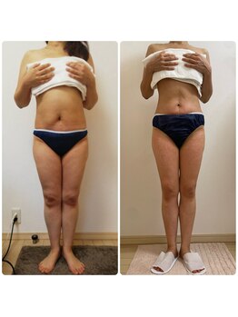 加圧ビューティーサロン スタイル エム(beauty salon style M)/50代/加圧×パワーツリー120分