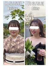 ハッチー(Hacchi)/【20代】頑張る花嫁様へ