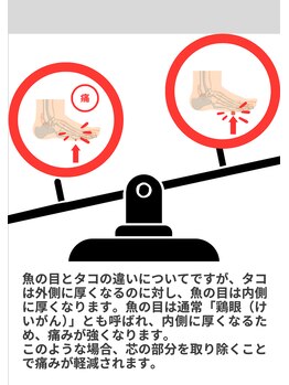ピーアンドオー(P&O)/