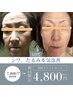 美肌メソッド【シミ・シワ・たるみ改善】60分4,800円
