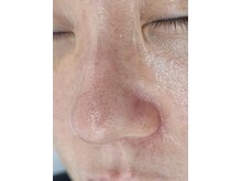 ケイビューティーセンター(K beauty center)