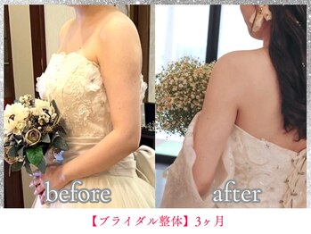 ボディメイク アールエフ サクラ接骨院(bodymake RF SAKURA接骨院)/ブライダルエステ（整体）3ヶ月