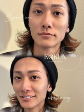 コクア(KOKUA)/ホワイトニング×アイブロウ