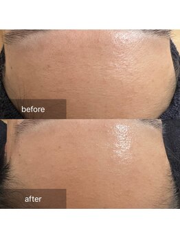 ナウ(now)/『陶肌トリートメント』