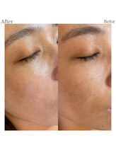 プリュスマイル(+Smile.)/フェイシャルワックス