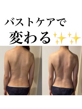 サロンツキ(salon tuki)/バストケア症例/徳島