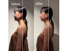 アンワインド(UNWIND)/驚き！！1回でこの変化