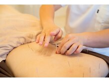 マーキュリー(Mercury)/腰痛のお悩み