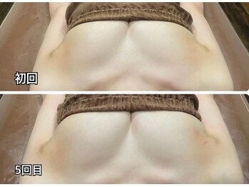 ロココ 四日市店(Rococo)/ふわふわボリュームバスト