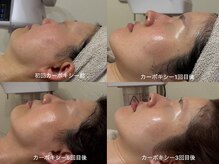 どこから見ても美しいお肌と見た目を同時に叶えたい方に♪