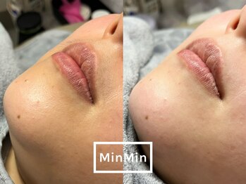 ルアナ(Luana.)/フェイシャルワックス