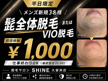 シャイン(SHINE)の写真