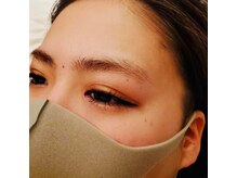 ミメル バイ ラフォンテ(mimelle by LAFONTE)/2まゆ毛Wax脱毛デザインbefore