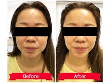 ドゥマイン(Do Mynd)/小顔