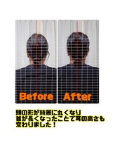 エビアス(Ebias)/シエル深頭αセラピー効果3