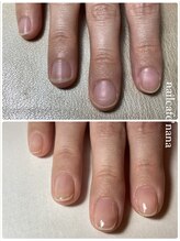 ネイルカフェ ナナ(nailcafe'nana)/自爪育成矯正