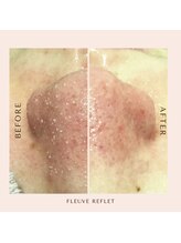 フルーヴ ルフレ(Fleuve Reflet)/3D「浮き出る毛穴ケア」★
