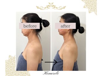 コモレビ(Komorebi)/