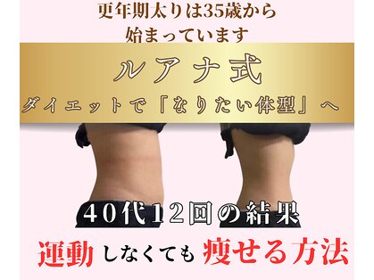 ルアナ(Luana.)の写真