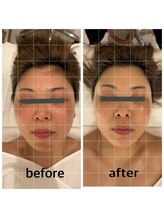 マインエム(mine.m)/頭蓋骨小顔矯正とフェイシャル