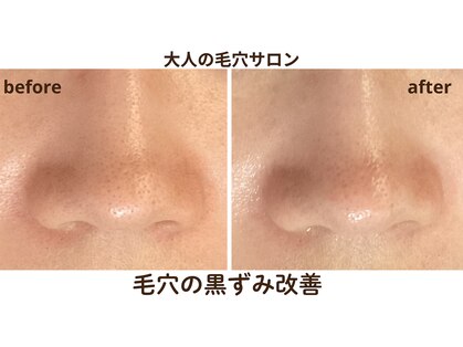 ダブルウエスト(Wwest)の写真