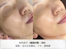 アストリエ グレース 相模大野(Astorie Grace)/継続ケアで肌の質が変わる！