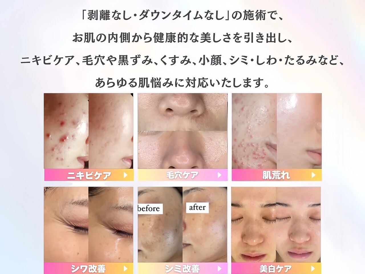 ホワイトアクア 鳳店(WHITE AQUA)｜ホットペッパービューティー