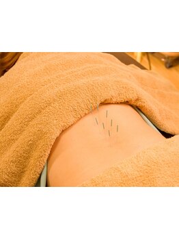 腰のつらさを改善したい